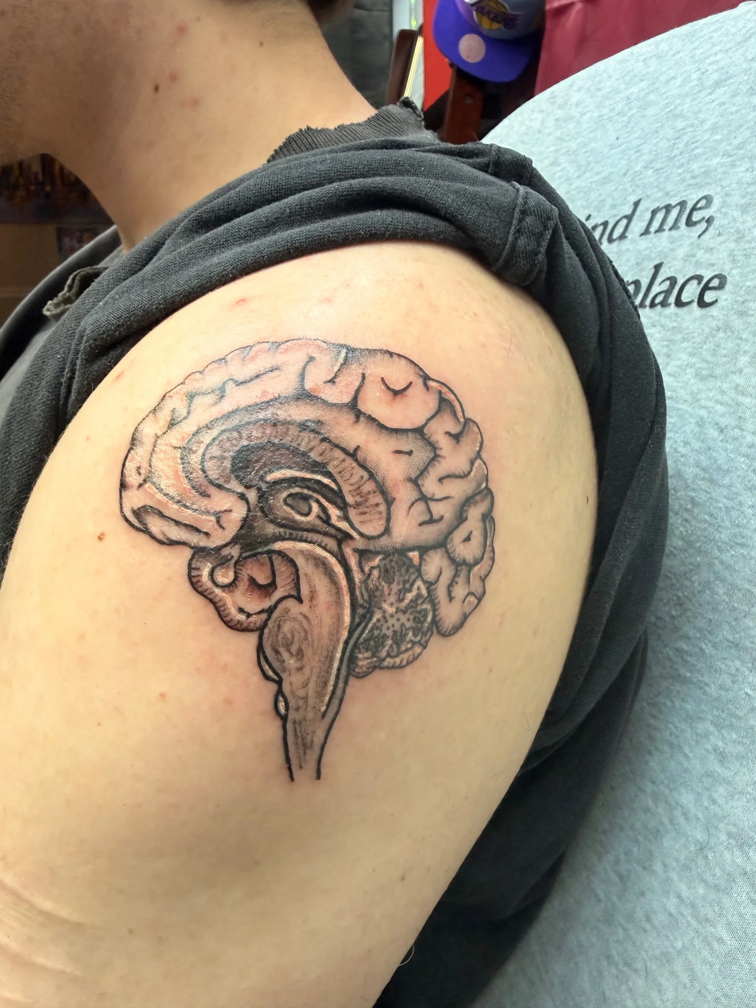 This is your brain, on arm…