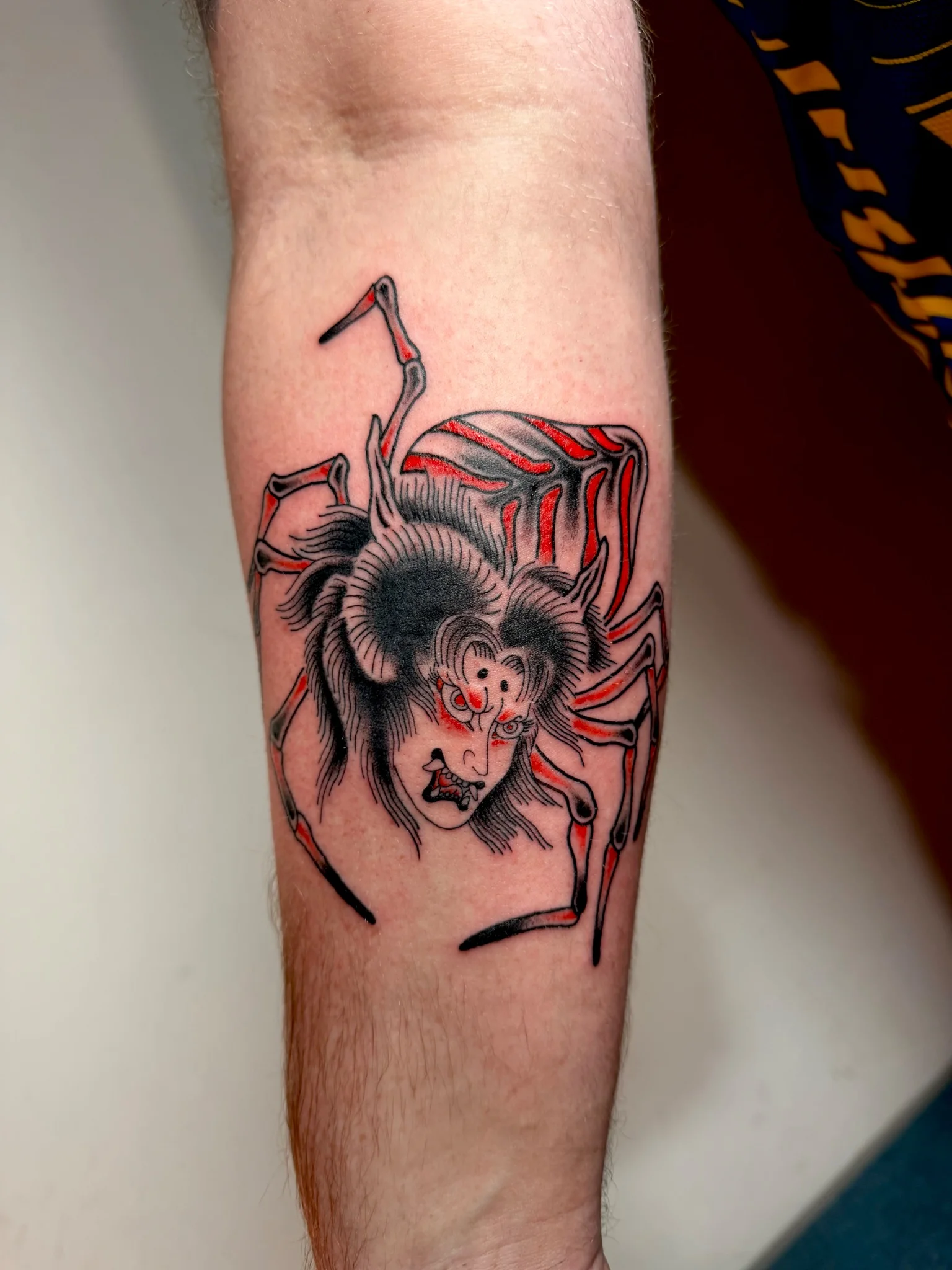 GAN