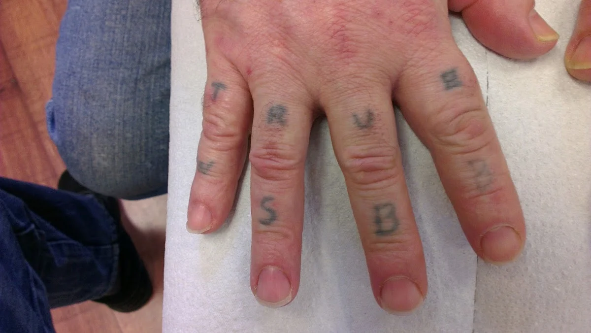 Oxford Tattoo Removal photo