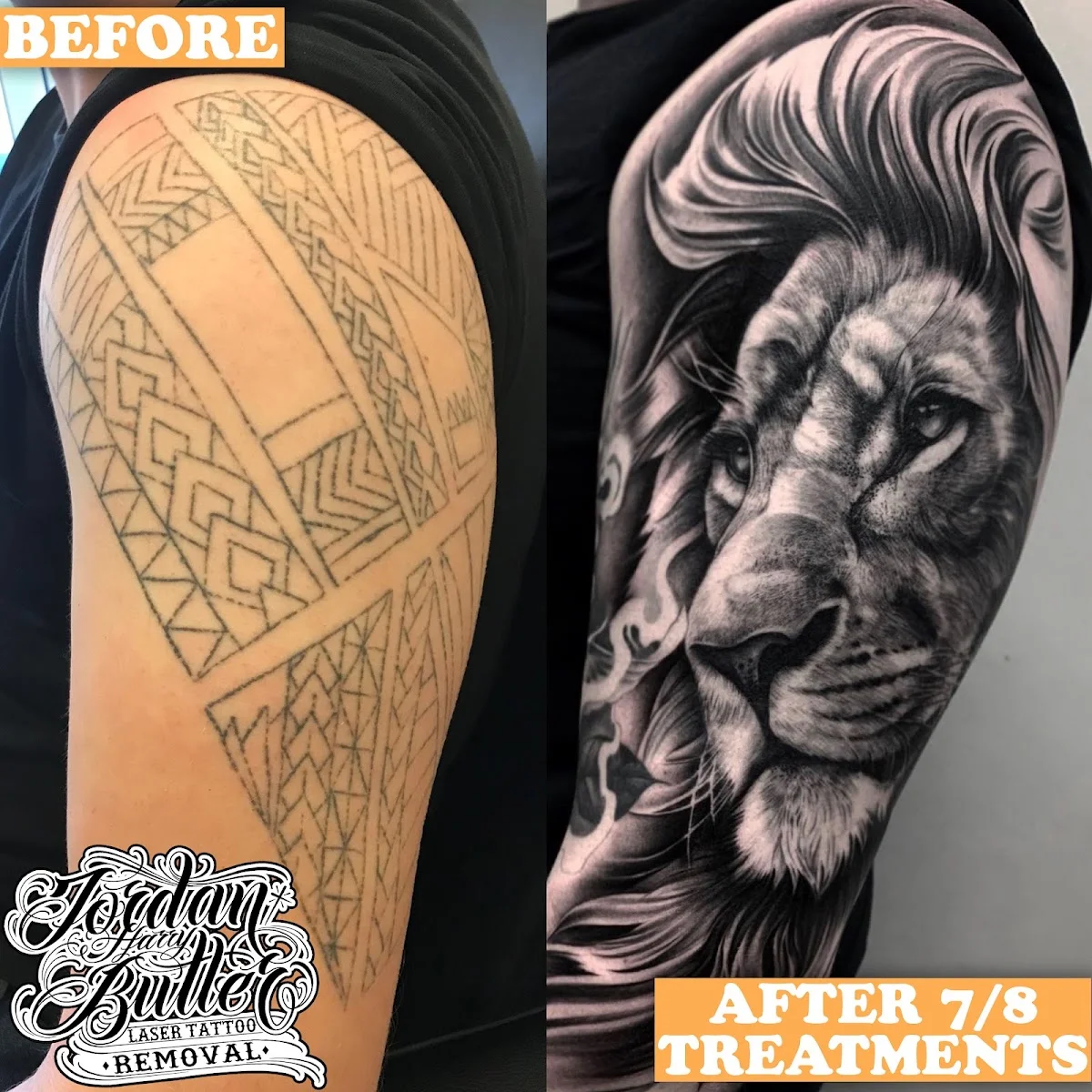 JHB Tattoo Removal tattoo shop in Peterborough, ENG