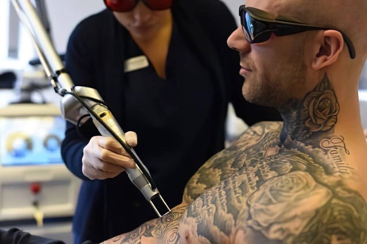 Oldham Tattoo Removal photo