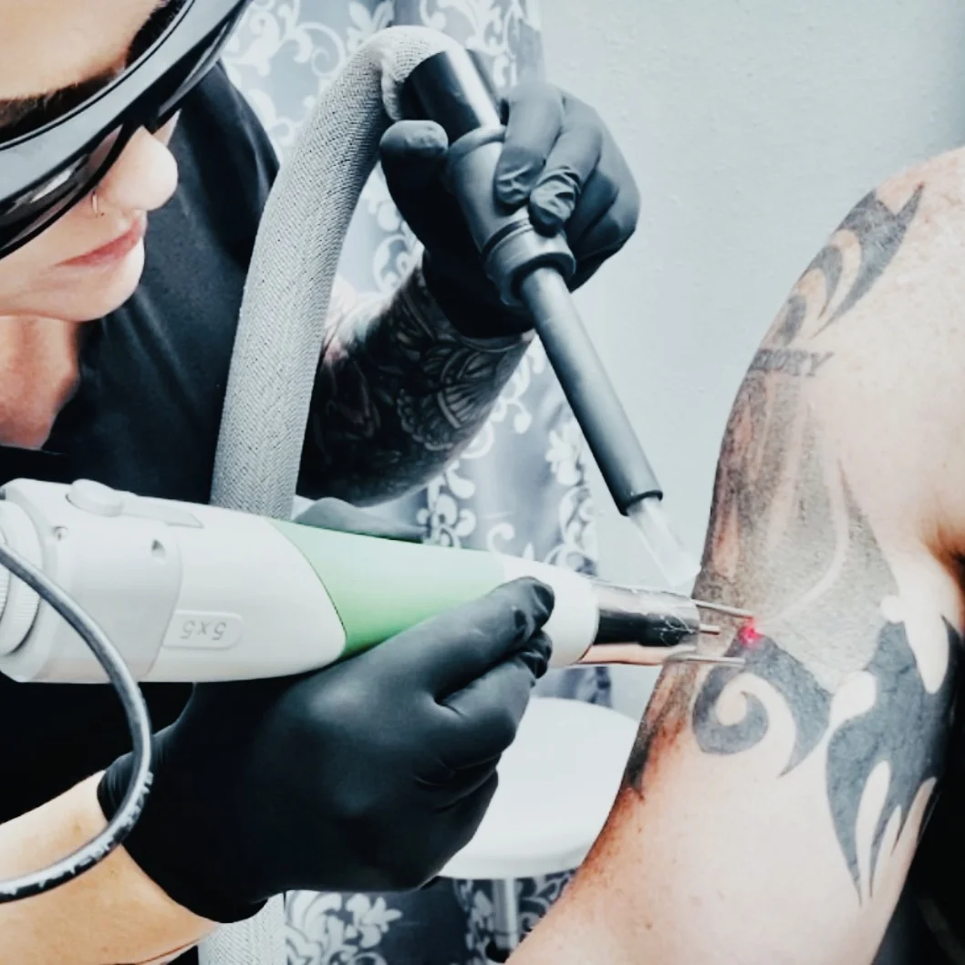 Denton Laser Tattoo Removal tattoo shop in Denton, TX