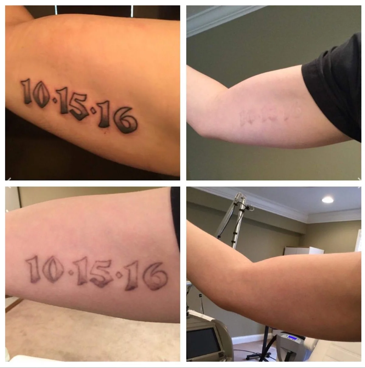 Lexington Tattoo Removal tattoo shop in Lexington, KY