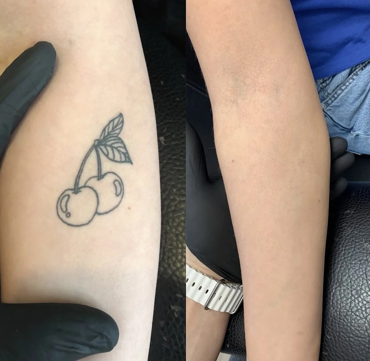 Skin City 13 & Laser tattoo removal tattoo shop in Farmington Hills, MI