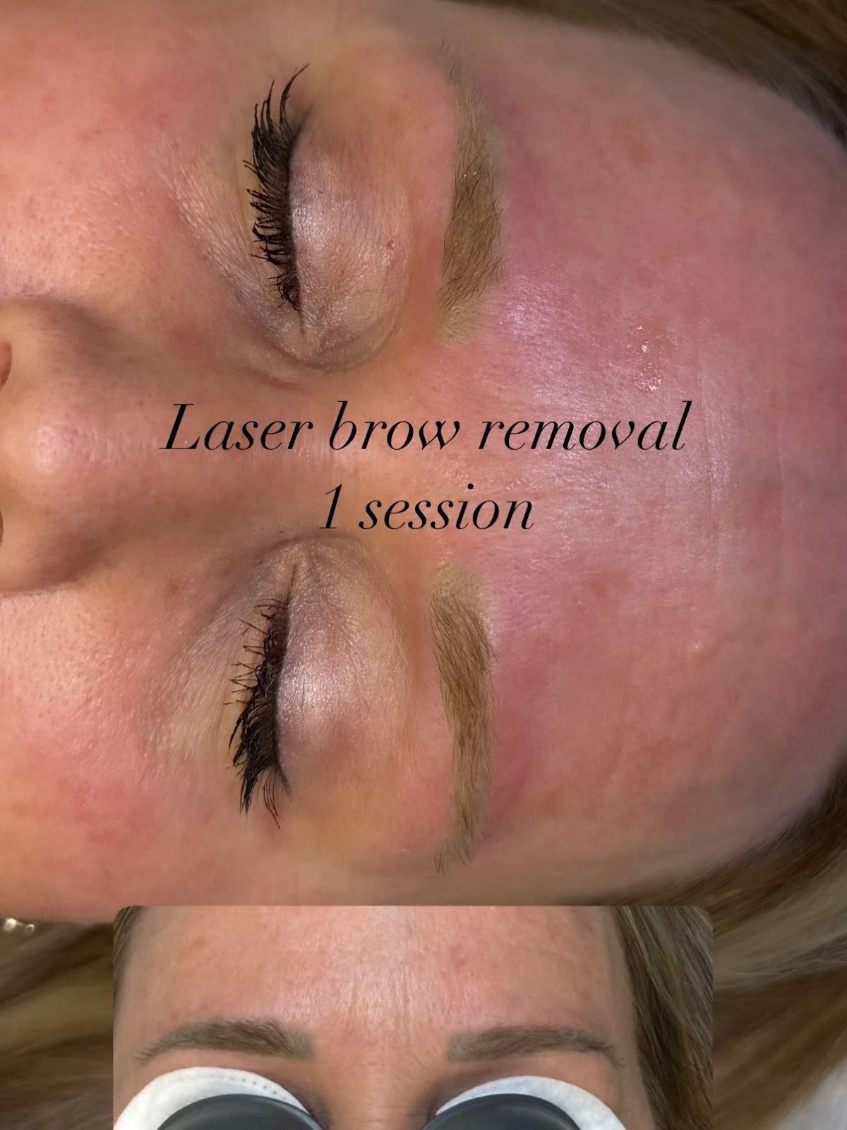 Utah Laser PMU & Tattoo Removal tattoo shop in West Jordan, UT